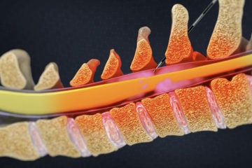 Pain Management Procedures