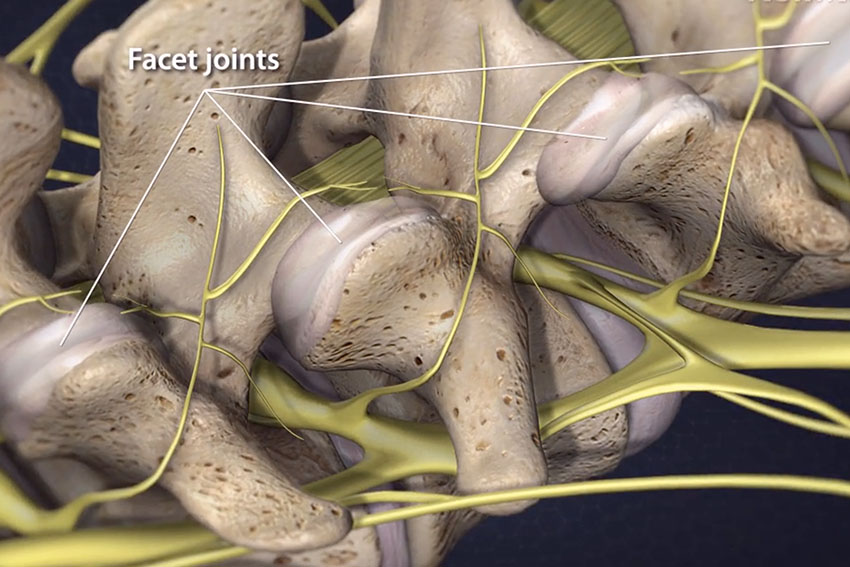 Endoscopic Surgery Carl Spivak, MD Executive Spine Surgery