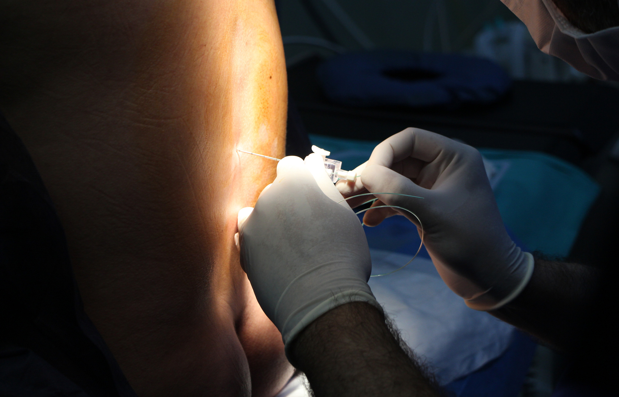 Are You a Candidate for Spinal Injections?