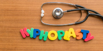 What is Kyphoplasty? What You Need to Know About This Minimally Invasive Treatment