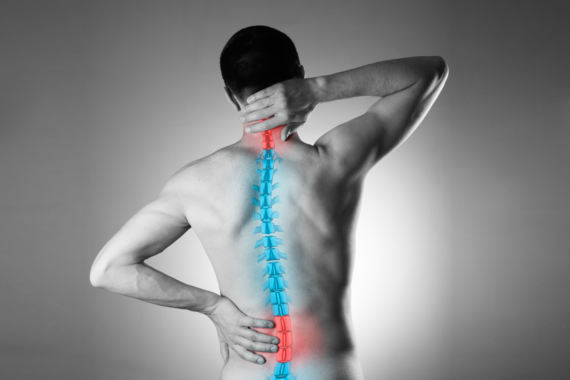 arthritis of the spine